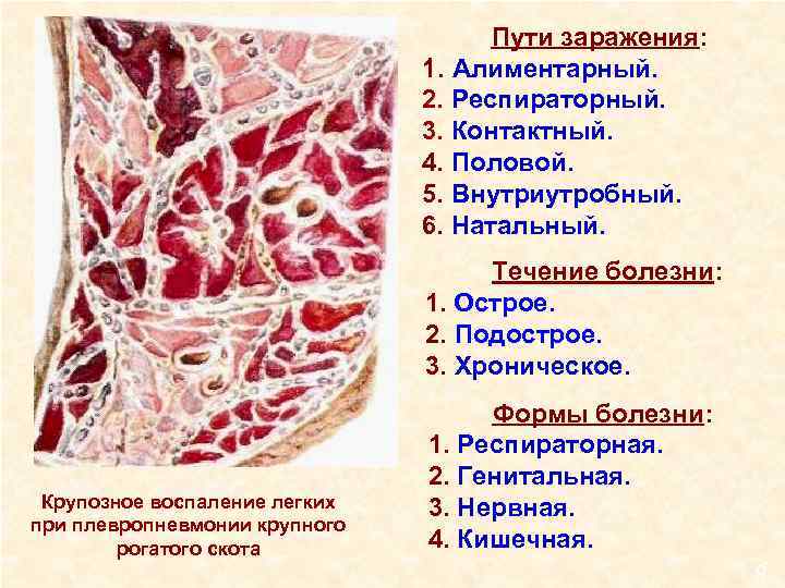 Пути заражения: 1. Алиментарный. 2. Респираторный. 3. Контактный. 4. Половой. 5. Внутриутробный. 6. Натальный.