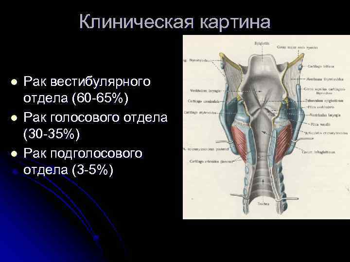 Клиническая картина l l l Рак вестибулярного отдела (60 -65%) Рак голосового отдела (30