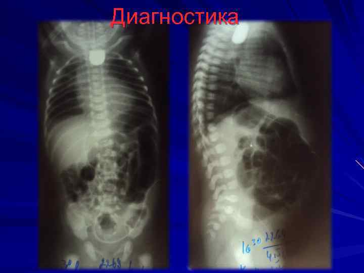 Диагностика 