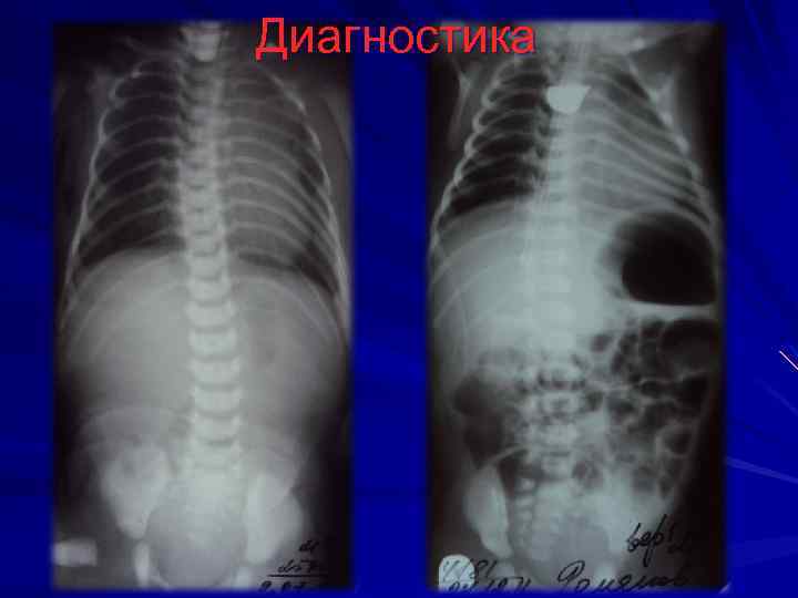 Диагностика 