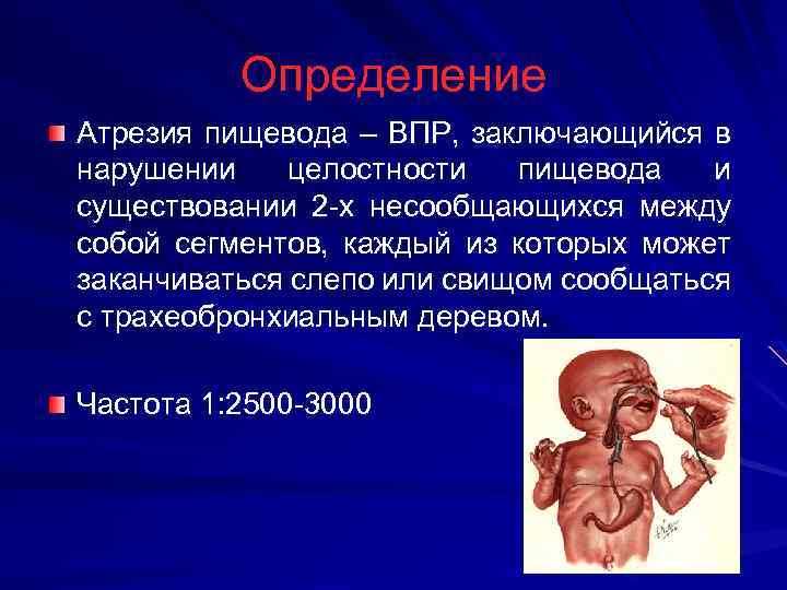 Определение Атрезия пищевода – ВПР, заключающийся в нарушении целостности пищевода и существовании 2 -х