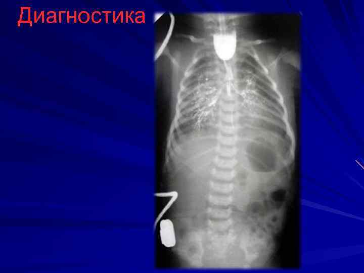 Диагностика 