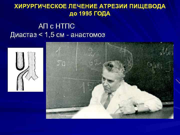 ХИРУРГИЧЕСКОЕ ЛЕЧЕНИЕ АТРЕЗИИ ПИЩЕВОДА до 1995 ГОДА АП с НТПС Диастаз < 1, 5