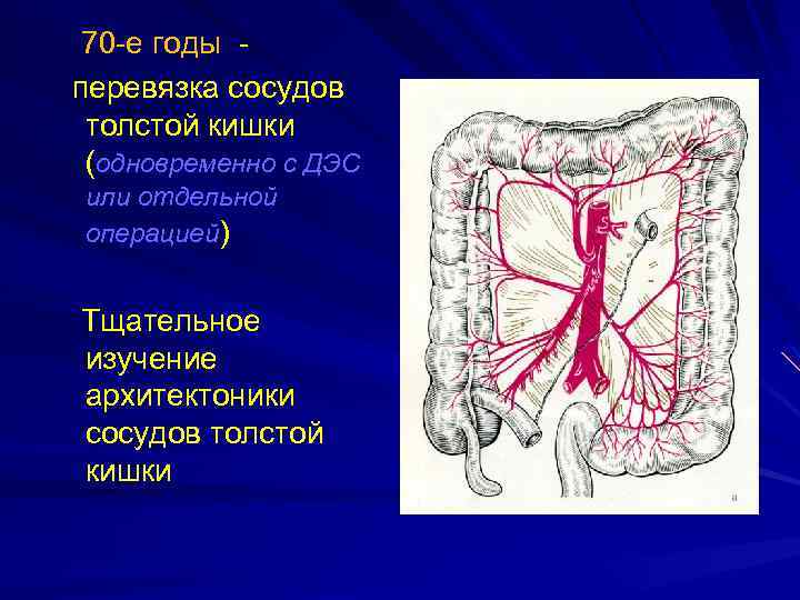 70 -е годы перевязка сосудов толстой кишки (одновременно с ДЭС или отдельной операцией) Тщательное