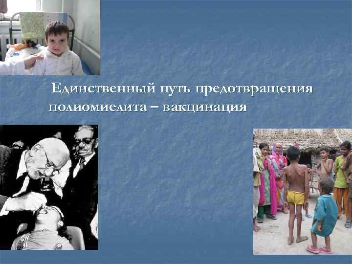 Единственный путь предотвращения полиомиелита – вакцинация 