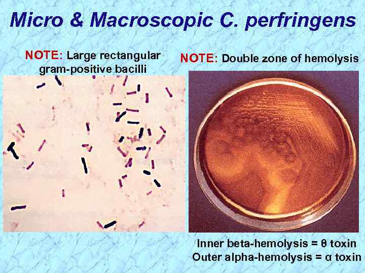 Micro & Macroscopic C. perfringens NOTE: Large rectangular gram-positive bacilli NOTE: Double zone of