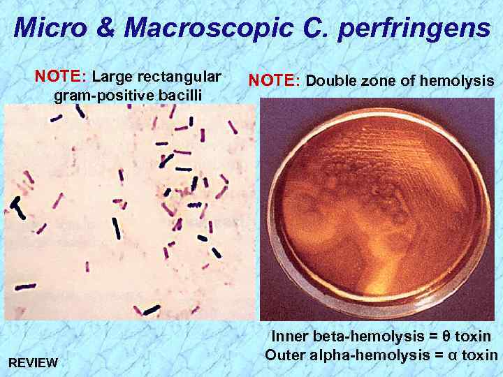 Micro & Macroscopic C. perfringens NOTE: Large rectangular gram-positive bacilli REVIEW NOTE: Double zone