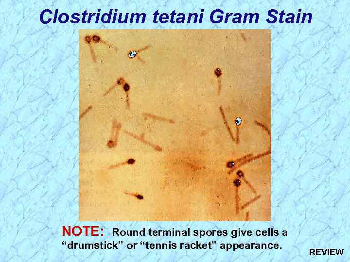 Clostridium tetani Gram Stain NOTE: Round terminal spores give cells a “drumstick” or “tennis