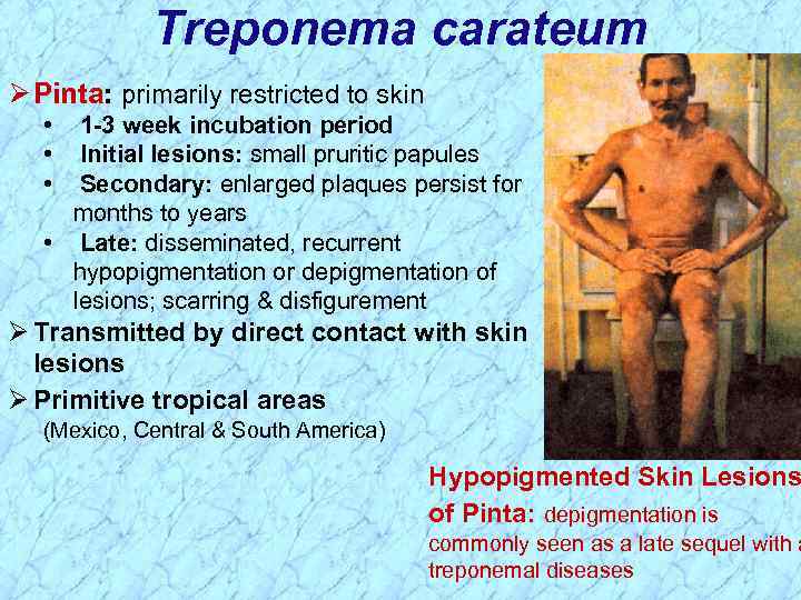 Treponema carateum Ø Pinta: primarily restricted to skin • • • 1 -3 week