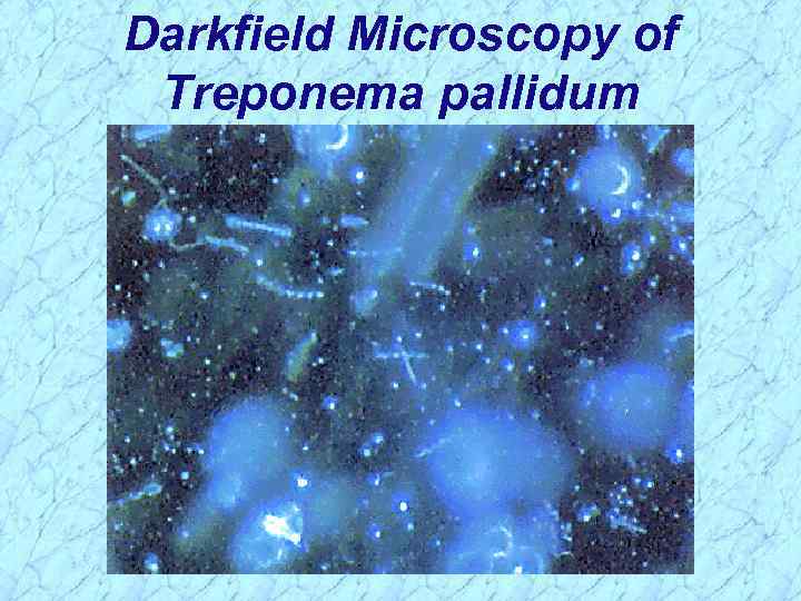 Darkfield Microscopy of Treponema pallidum 