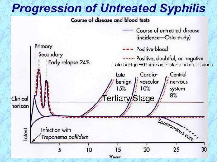 Progression of Untreated Syphilis Late benign Gummas in skin and soft tissues Tertiary Stage