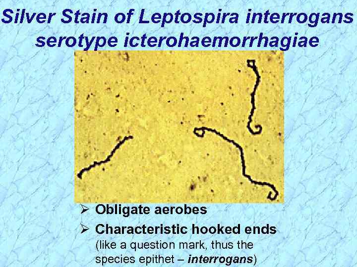 Silver Stain of Leptospira interrogans serotype icterohaemorrhagiae Ø Obligate aerobes Ø Characteristic hooked ends