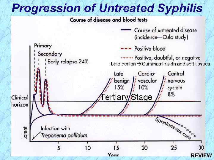 Progression of Untreated Syphilis Late benign Gummas in skin and soft tissues Tertiary Stage