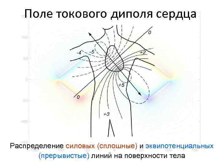 Поле токового диполя сердца Распределение силовых (сплошные) и эквипотенциальных (прерывистые) линий на поверхности тела