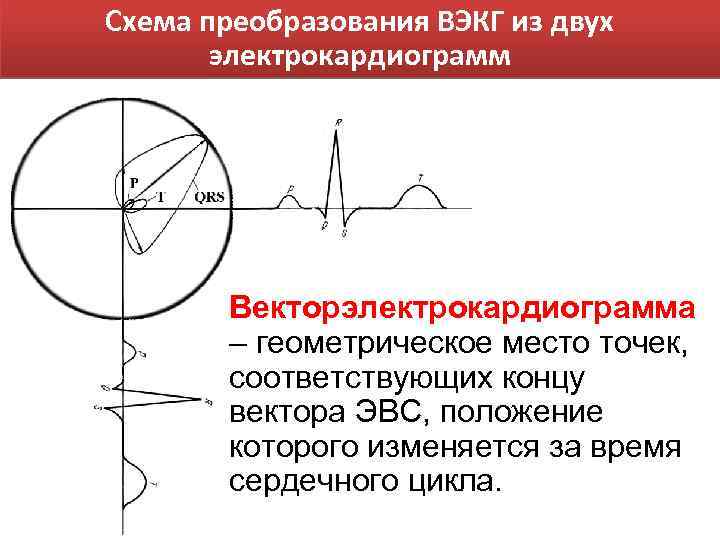 Схема преобразования ВЭКГ из двух электрокардиограмм Векторэлектрокардиограмма – геометрическое место точек, соответствующих концу вектора