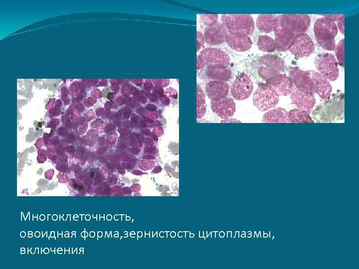 Многоклеточность, овоидная форма, зернистость цитоплазмы, включения 