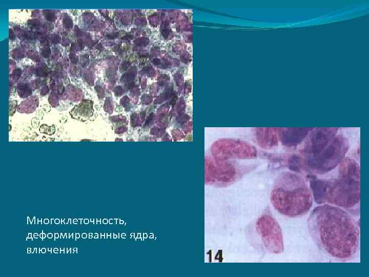 Многоклеточность, деформированные ядра, влючения 
