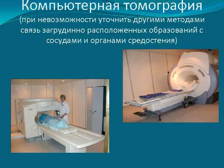 Компьютерная томография (при невозможности уточнить другими методами связь загрудинно расположенных образований с сосудами и