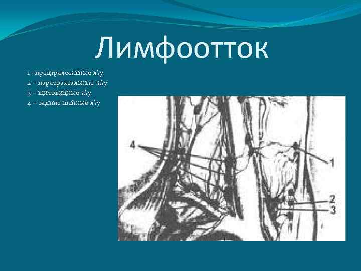 Лимфоотток 1 –предтрахеальные лу 2 – паратрахеальные лу 3 – щитовидные лу 4 –