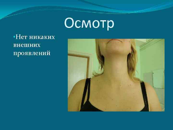 Осмотр • Нет никаких внешних проявлений 