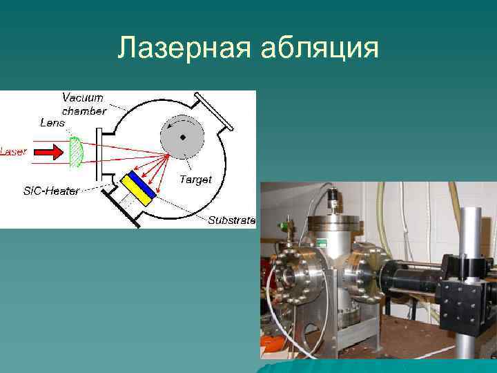 Лазерная абляция 