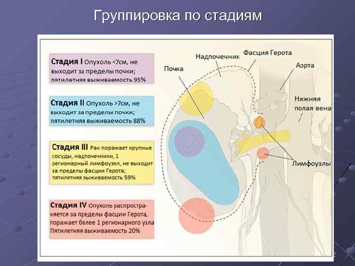 Группировка по стадиям 12 