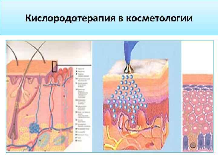 Кислородотерапия в косметологии 