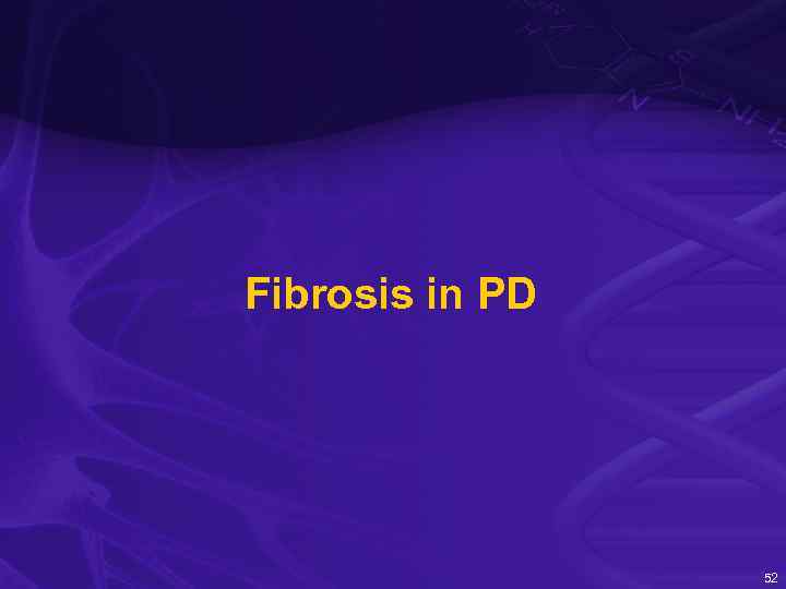 Fibrosis in PD 52 