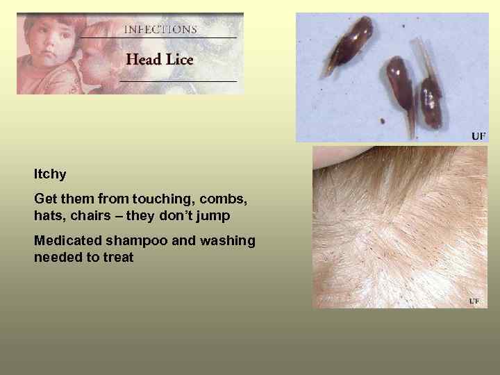 Itchy Get them from touching, combs, hats, chairs – they don’t jump Medicated shampoo