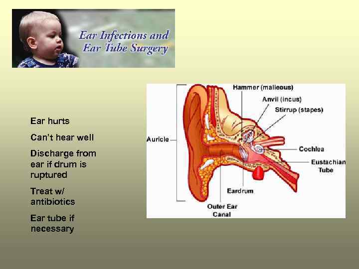 Ear hurts Can’t hear well Discharge from ear if drum is ruptured Treat w/