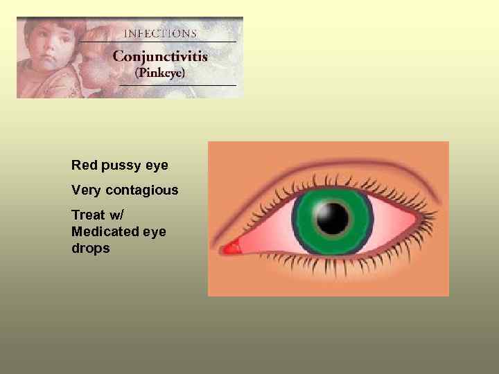 Red pussy eye Very contagious Treat w/ Medicated eye drops 