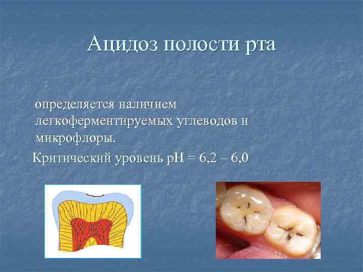 Ацидоз полости рта определяется наличием легкоферментируемых углеводов и микрофлоры. Критический уровень р. Н =