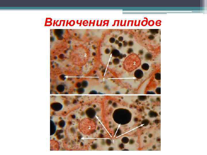 Включения липидов 