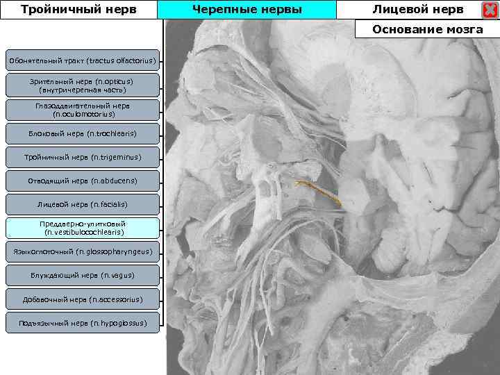 Тройничный нерв Черепные нервы Лицевой нерв Основание мозга Обонятельный тракт (tractus olfactorius) Зрительный нерв