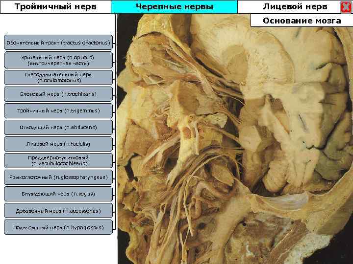 Тройничный нерв Черепные нервы Лицевой нерв Основание мозга Обонятельный тракт (tractus olfactorius) Зрительный нерв