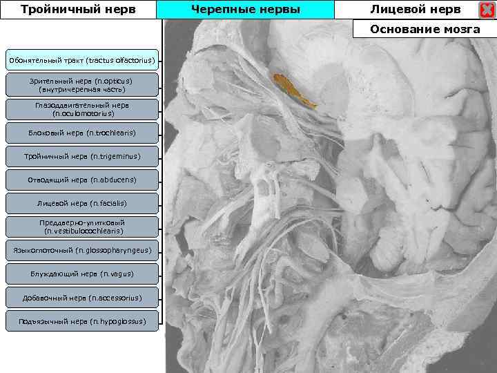 Тройничный нерв Черепные нервы Лицевой нерв Основание мозга Обонятельный тракт (tractus olfactorius) Зрительный нерв