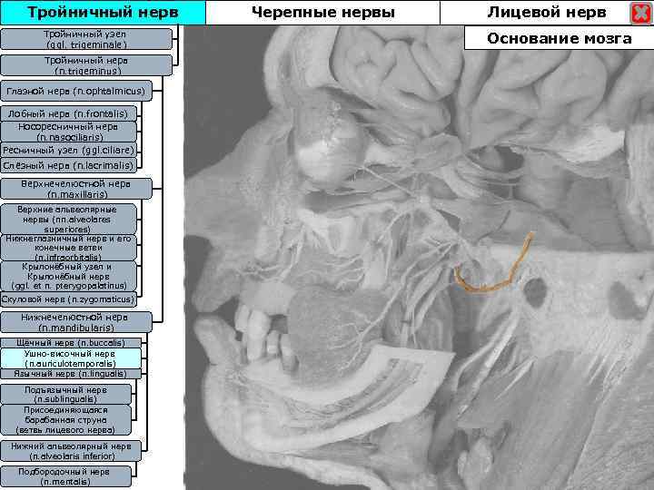 Тройничный нерв Тройничны узел Тройничныйузел (ggl. trigeminale) Тройничный нерв (n. trigeminus) Глазной нерв (n.
