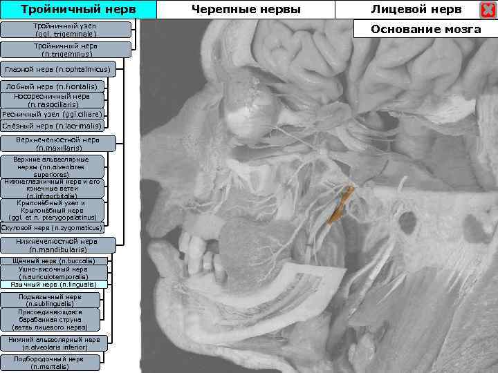 Тройничный нерв Тройничны узел Тройничныйузел (ggl. trigeminale) Тройничный нерв (n. trigeminus) Глазной нерв (n.