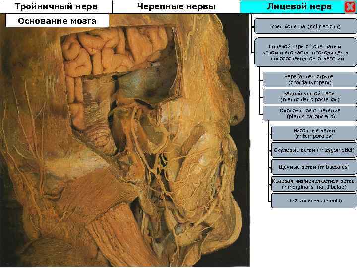 Тройничный нерв Основание мозга Черепные нервы Лицевой нерв Узел коленца (ggl. geniculi) Лицевой нерв