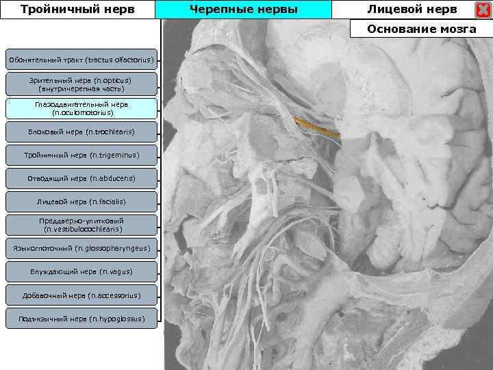 Тройничный нерв Черепные нервы Лицевой нерв Основание мозга Обонятельный тракт (tractus olfactorius) Зрительный нерв