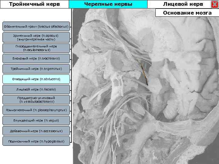 Тройничный нерв Черепные нервы Лицевой нерв Основание мозга Обонятельный тракт (tractus olfactorius) Зрительный нерв