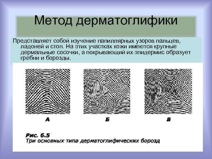 Метод дерматоглифики Представляет собой изучение папиллярных узоров пальцев, ладоней и стоп. На этих участках