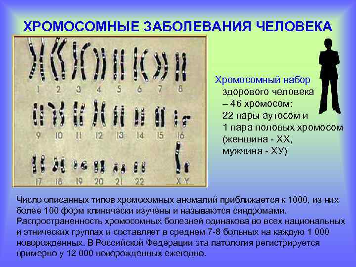 ХРОМОСОМНЫЕ ЗАБОЛЕВАНИЯ ЧЕЛОВЕКА Хромосомный набор здорового человека – 46 хромосом: 22 пары аутосом и