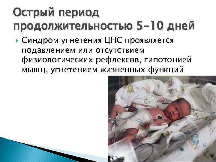 Острый период продолжительностью 5 -10 дней Синдром угнетения ЦНС проявляется подавлением или отсутствием физиологических