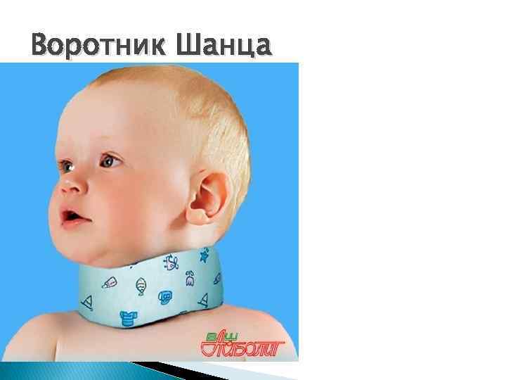 Воротник Шанца 