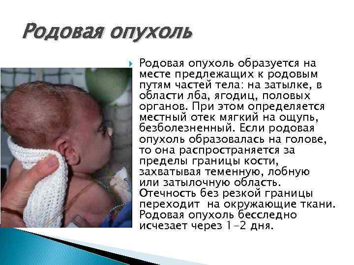 Родовая опухоль образуется на месте предлежащих к родовым путям частей тела: на затылке, в