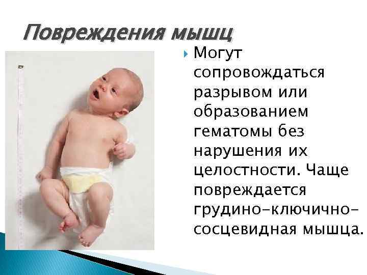 Повреждения мышц Могут сопровождаться разрывом или образованием гематомы без нарушения их целостности. Чаще повреждается