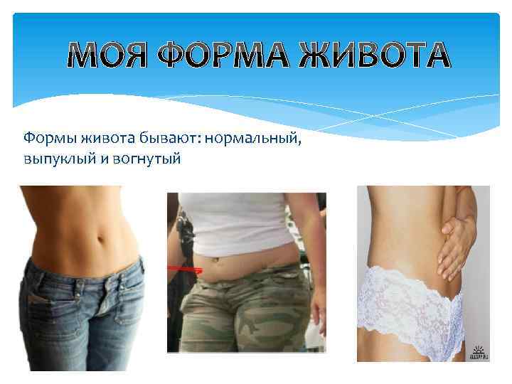 МОЯ ФОРМА ЖИВОТА Формы живота бывают: нормальный, выпуклый и вогнутый 