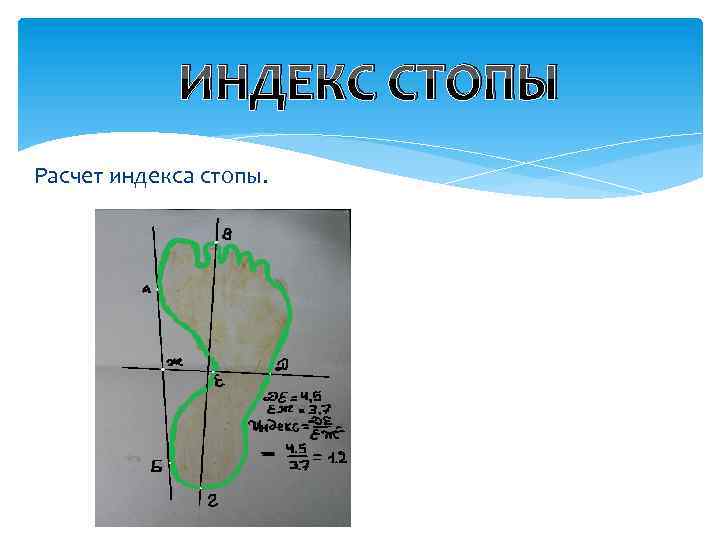 ИНДЕКС СТОПЫ Расчет индекса стопы. 