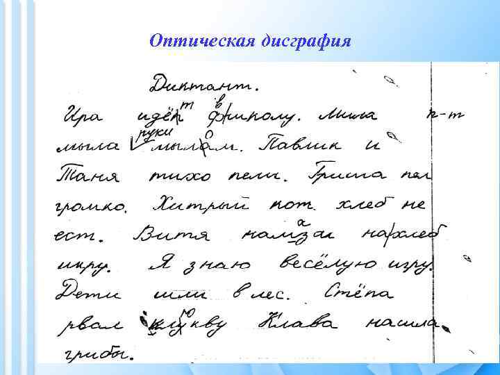 Оптическая дисграфия 